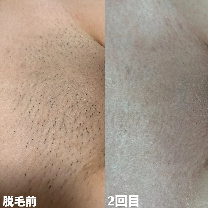 画像253